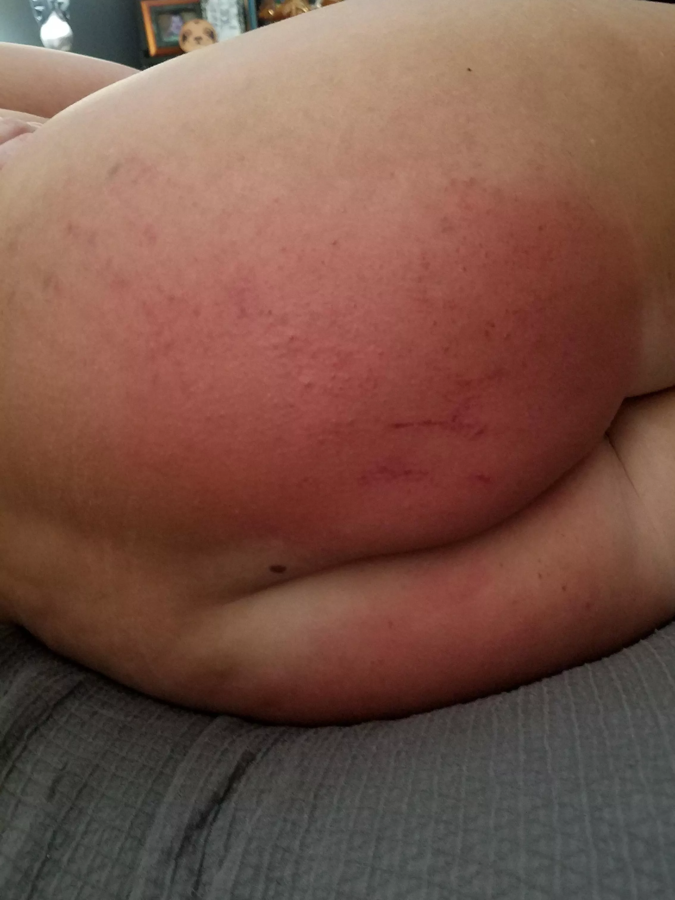 The results of a four handed spanking! posted by heinousk