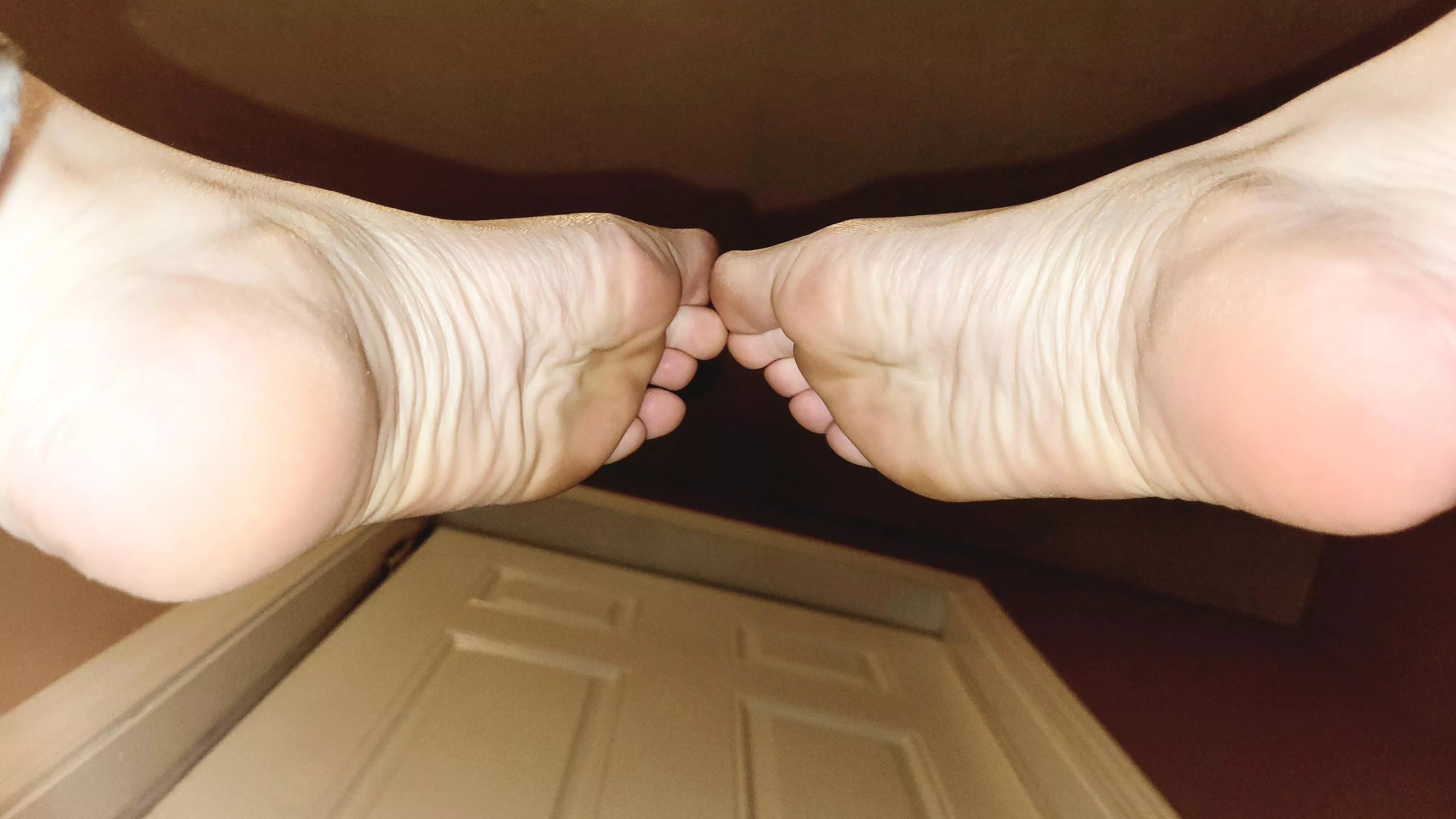 The soles of a woman on her feet all day. posted by Solelesswanderer21