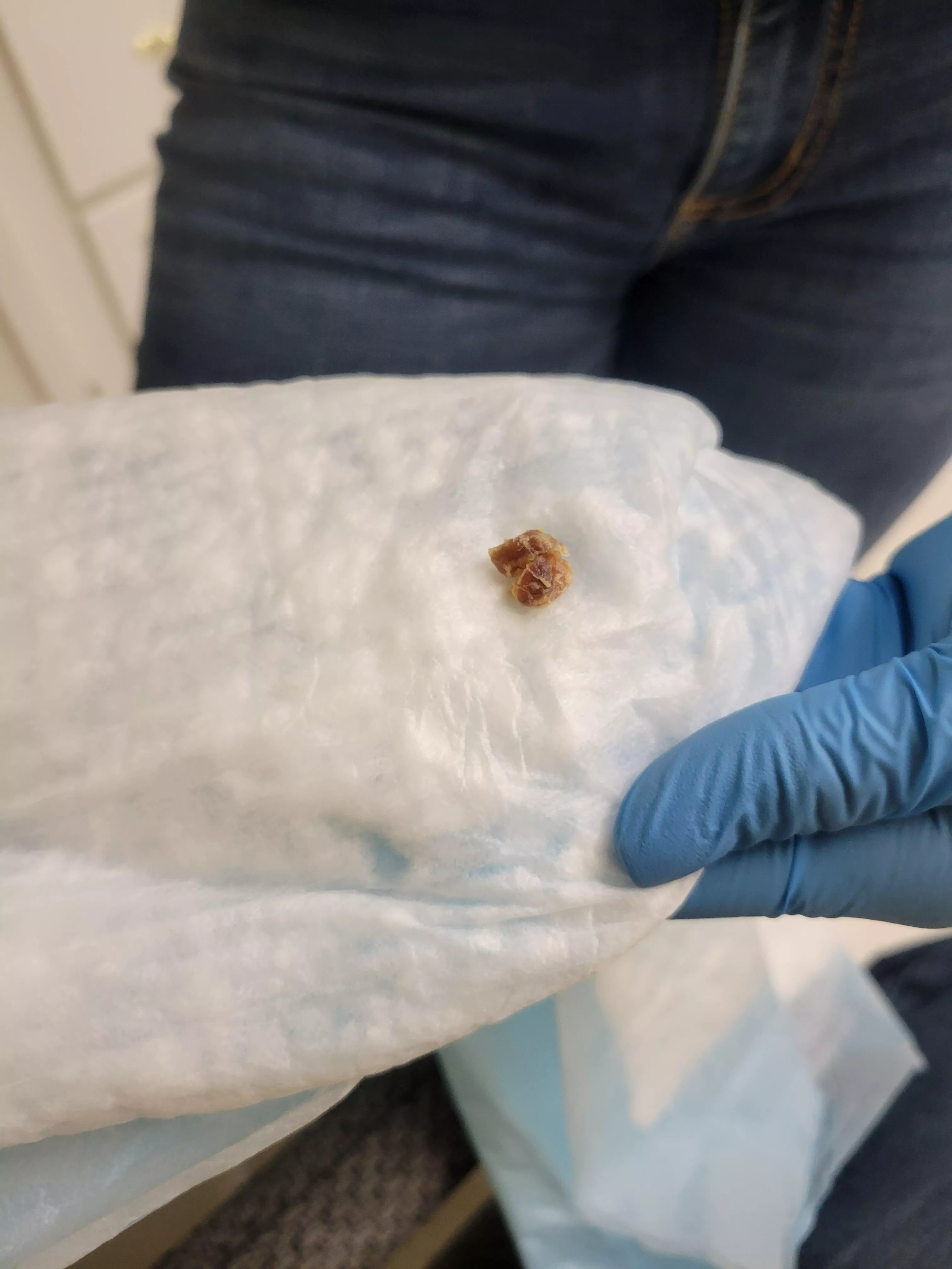 The stowaway. This came out of my ear today. posted by Memeboius