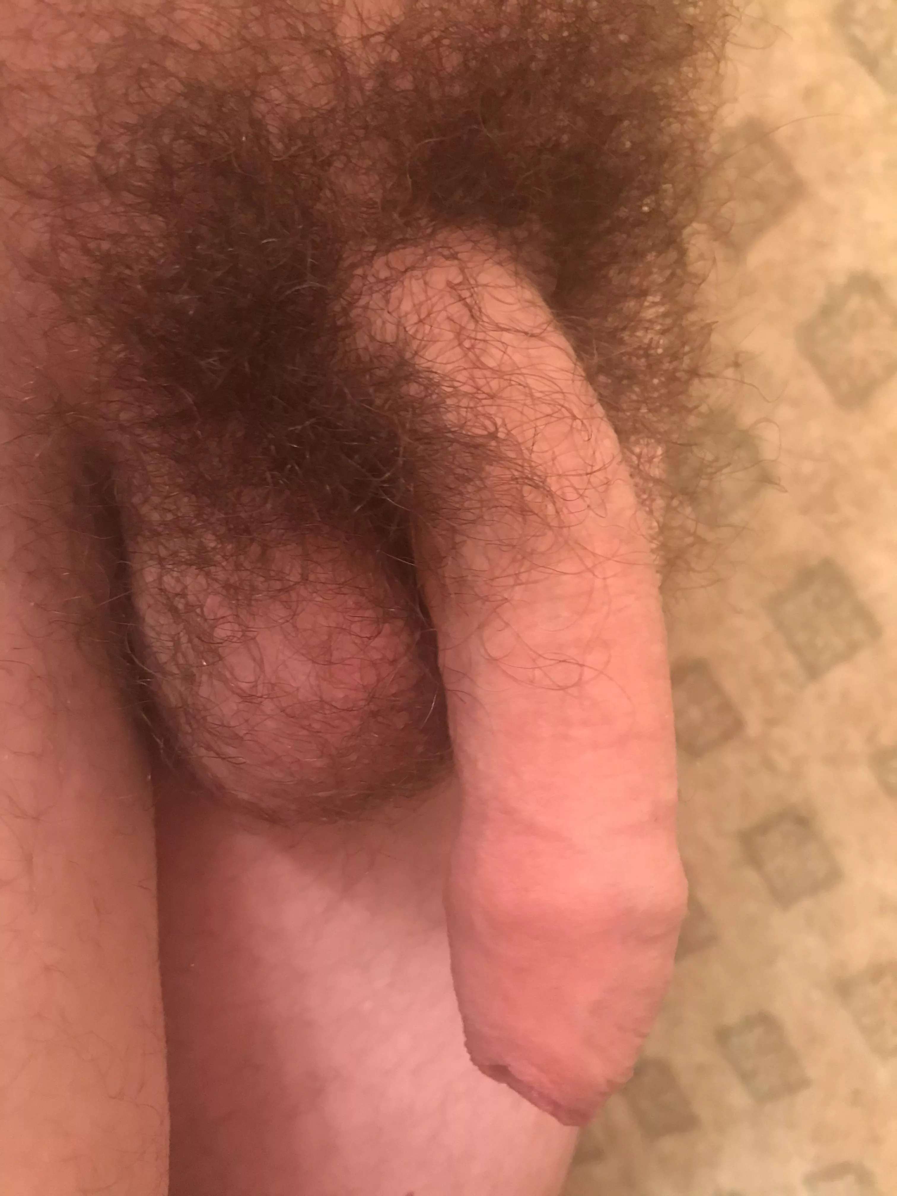 Thoughts on my foreskin? posted by Yeldarbkh