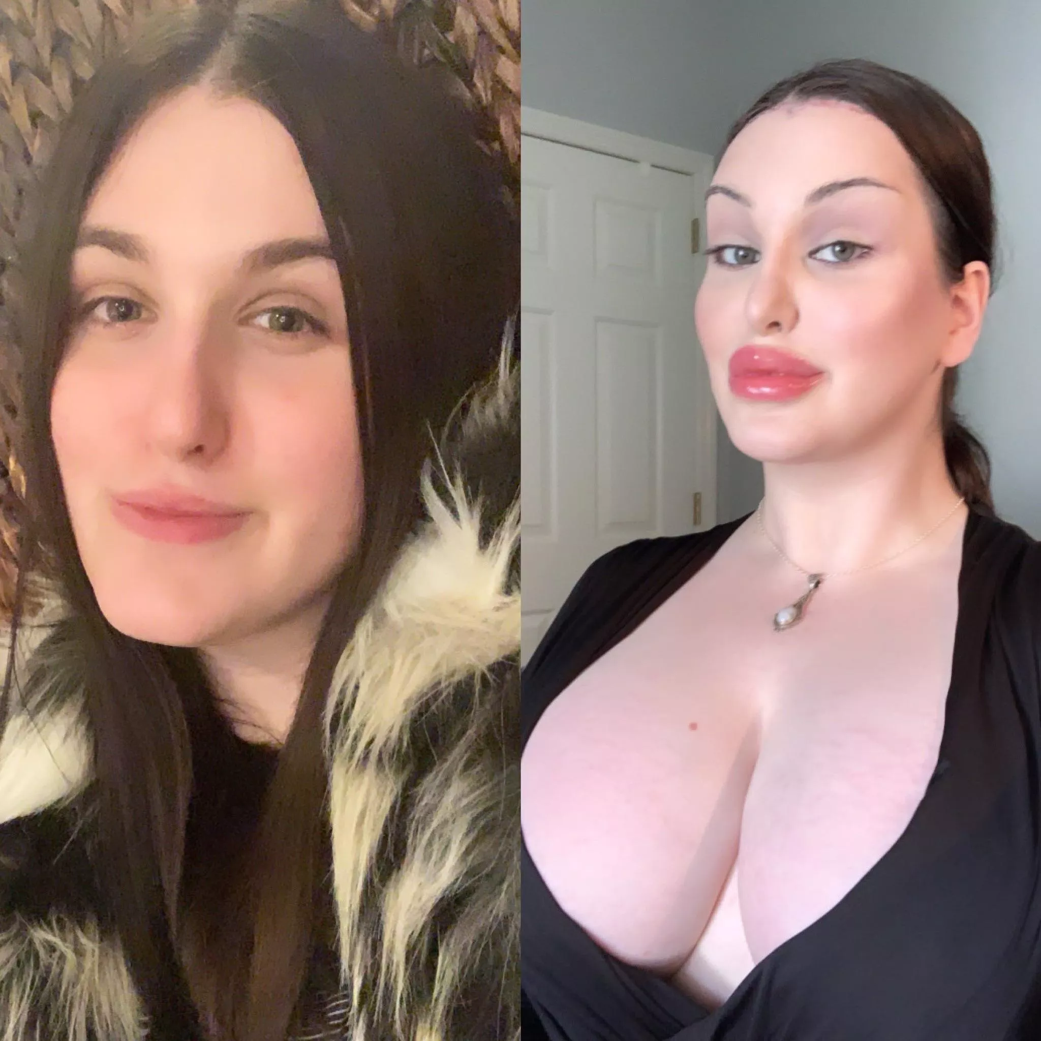 Trans Bimbo of The Year: 2020-2021 (Next Step 2,500cc+ Breast Expanders!) posted by BornToBeHer