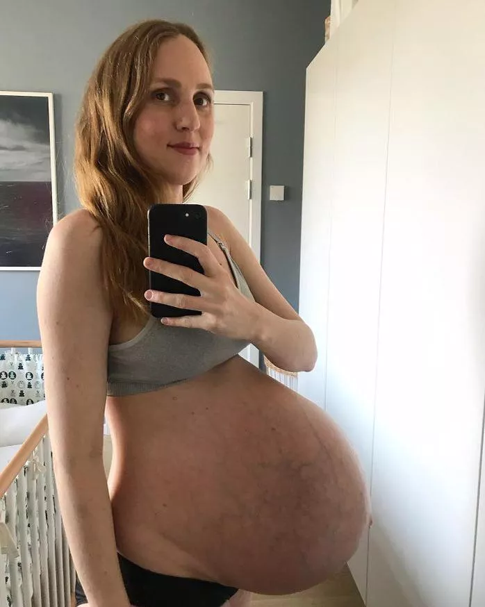 Triplet Belly posted by redditporning3