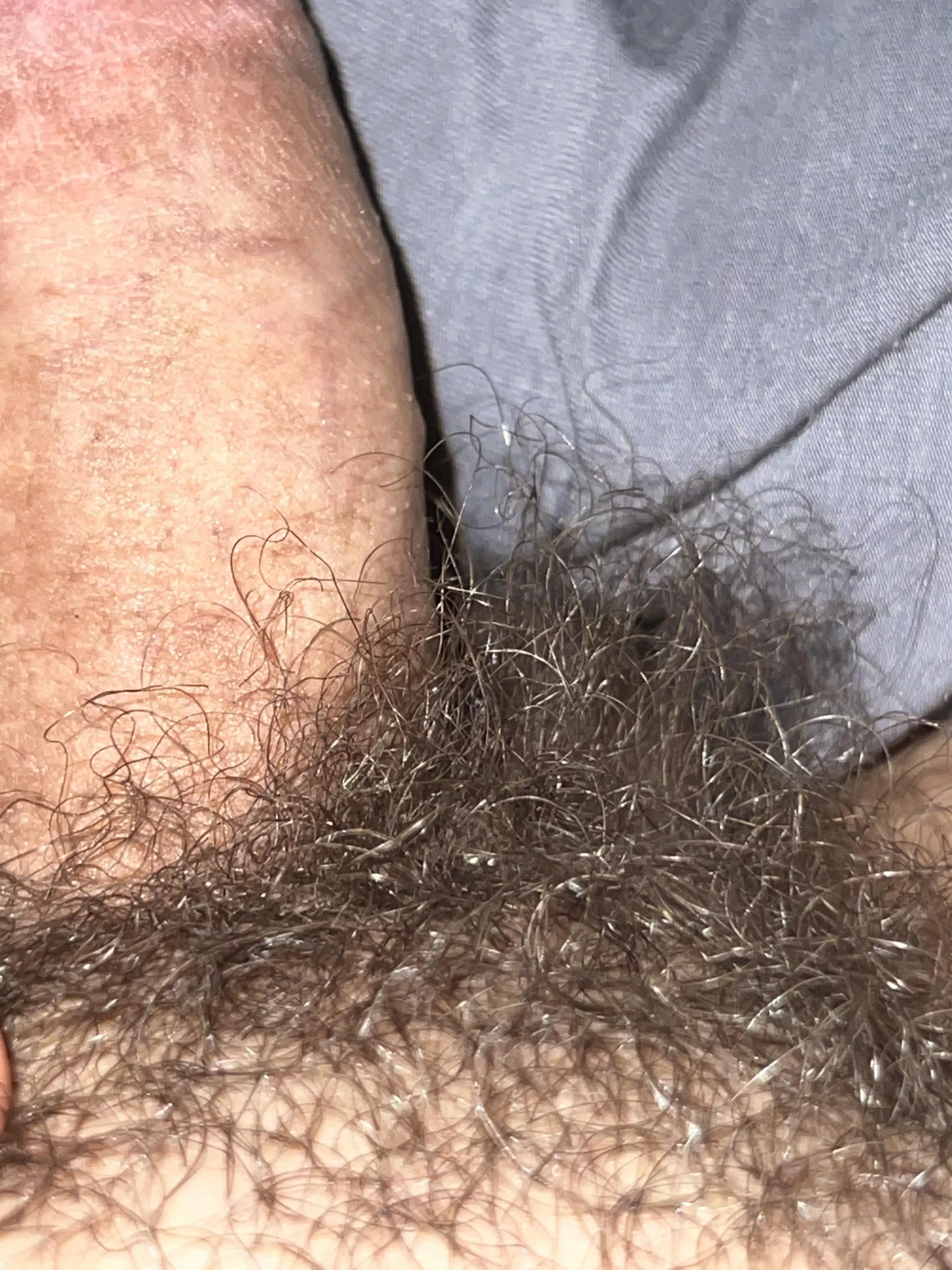 Up, close, and untrimmed for months posted by Mtn_Masc_Man