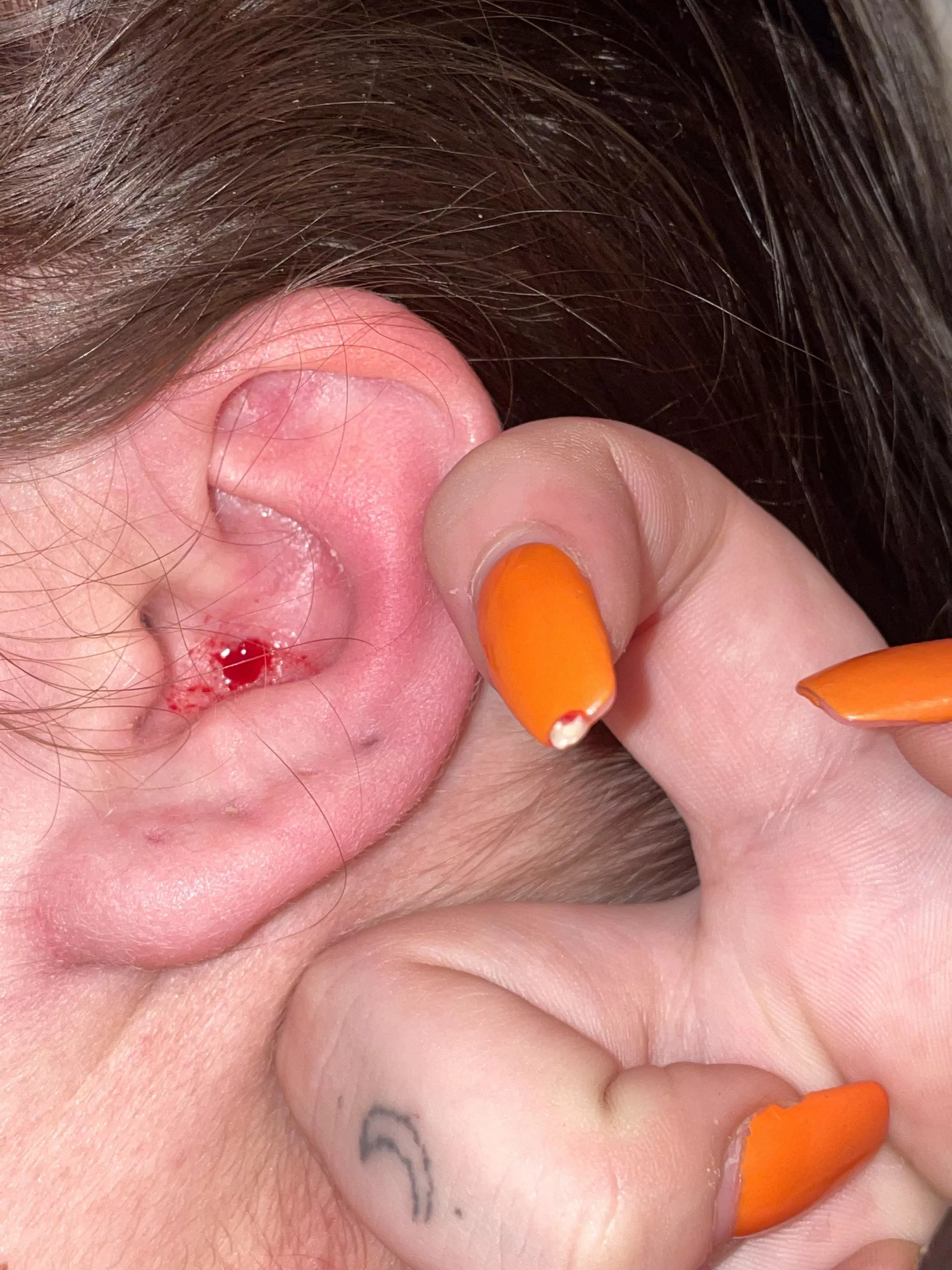 very nice ear pop but painful posted by yeetmymeattotgebeat