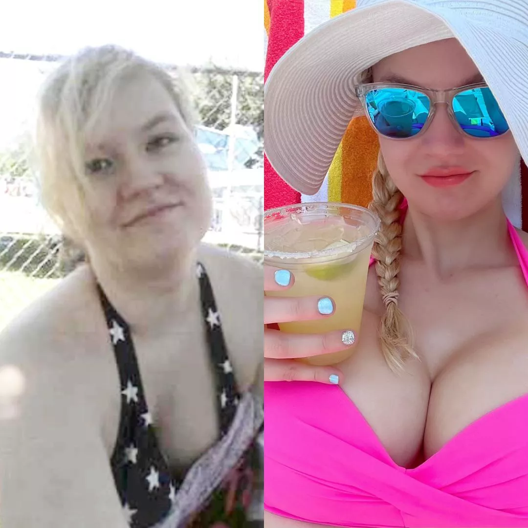 Weight loss, lip injections, boob job: My progress so far [OC] posted by misserikaeverly