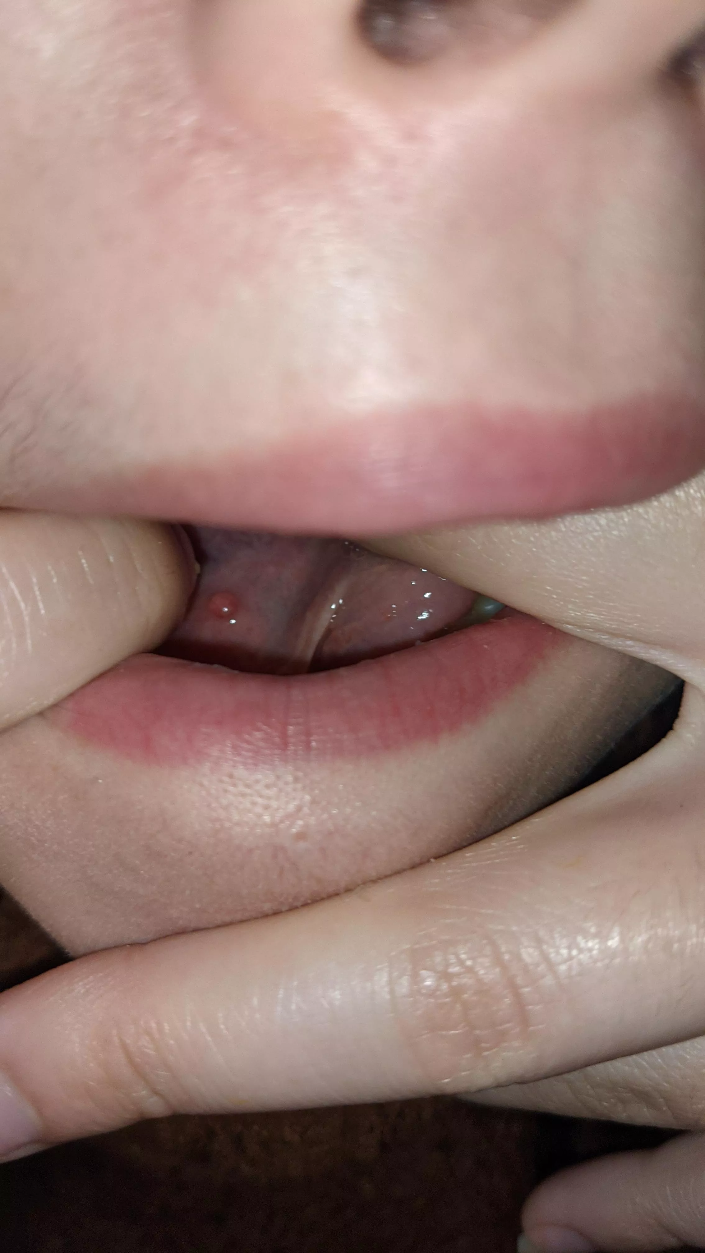 Weird lump under my tongue??? Does anyone know what it is? posted by GraceyBabey