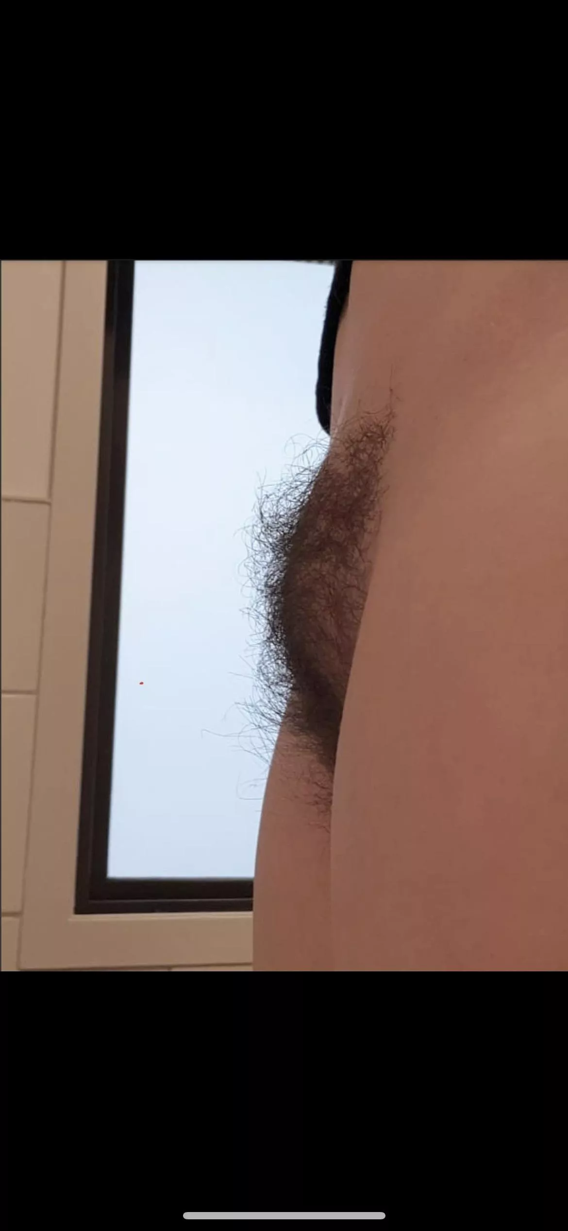 What do you think of a hairy mound? posted by aabir192