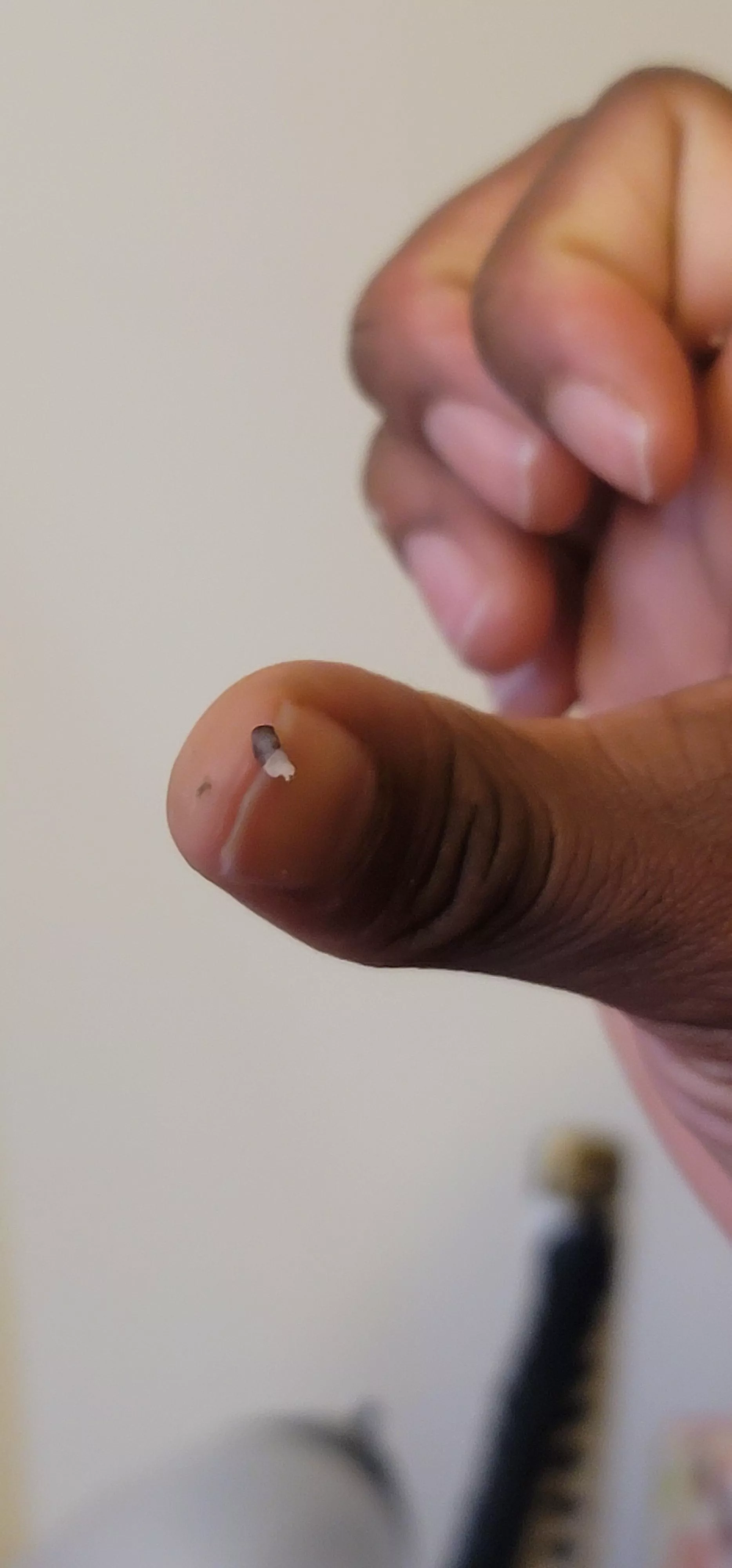 Wild blackhead that came out of where the sun don't shine. Happy new yearl posted by meh__-_-