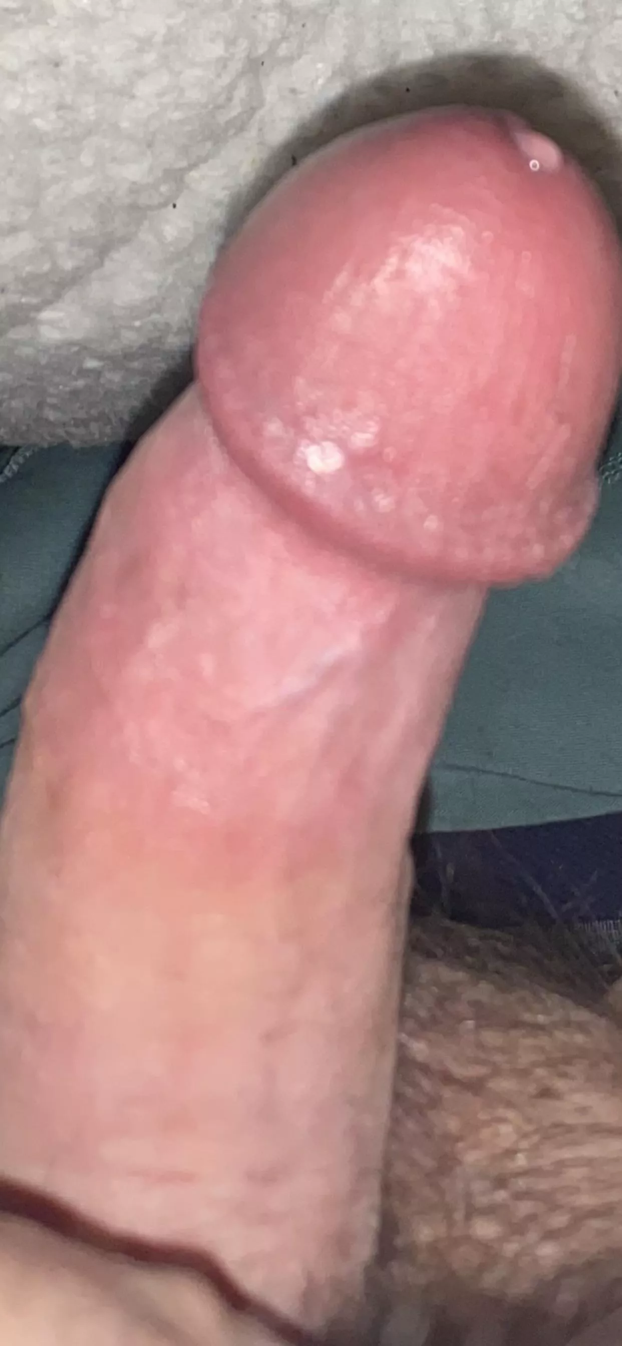 Woke up like this! Anyone want to finish it off posted by smdftb83